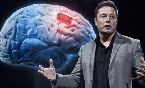 Elon Musk Siapkan Terobosan Menanam Chip di Otak Manusia
